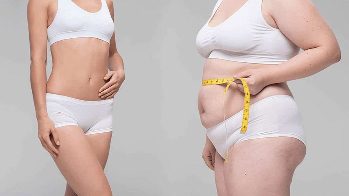 هزینه عمل پیکرتراشی قیمت جراحی پیکرتراشی