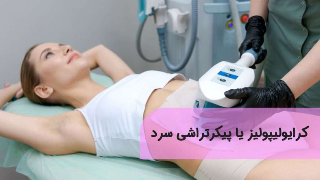 کرایولیپولیز یا پیکرتراشی سرد
