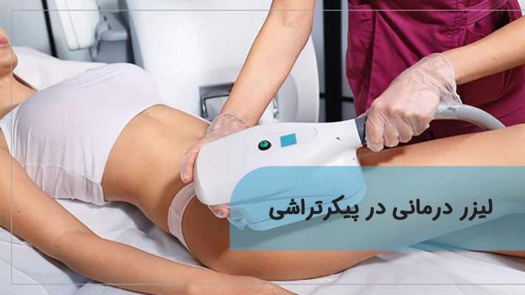 لیزر درمانی در پیکرتراشی