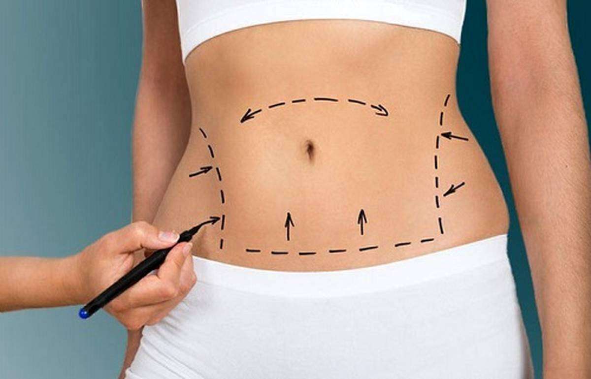 عمل لیپوماتیک