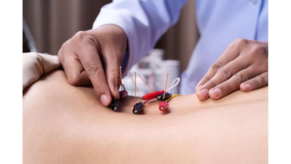 جلسات طب سوزنی به عواملی بستگی دارد تعداد جلسات طب سوزنی