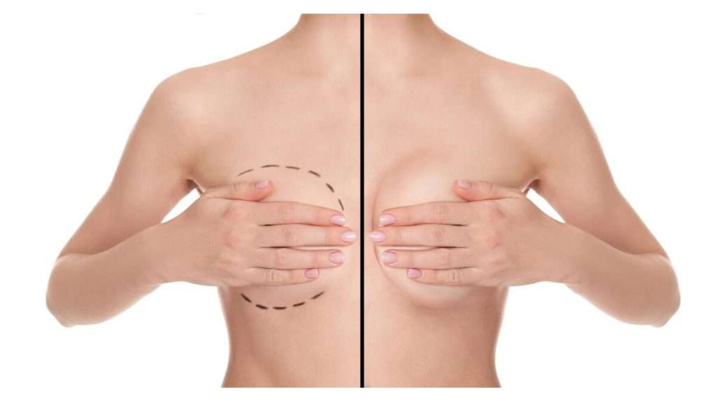 کاهش عوارض پروتز سینه عوارض احتمالی پروتز سینه