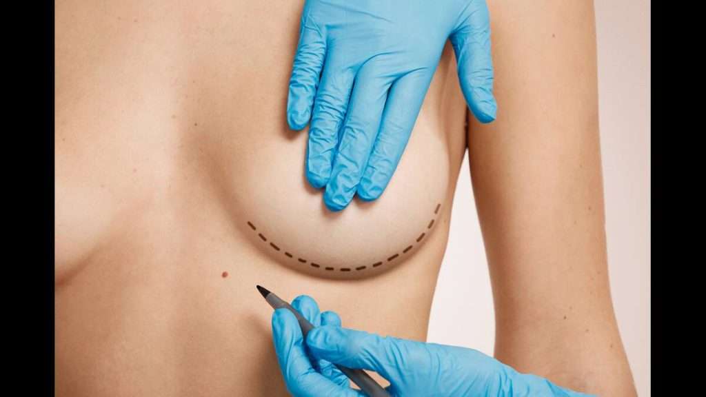 پروتز سینه طبیعی تر