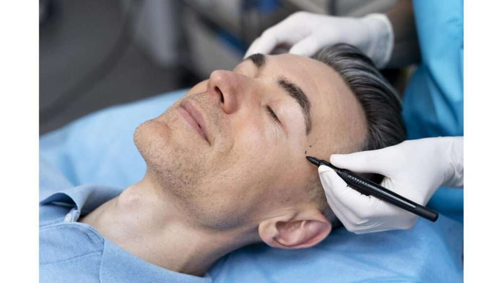 نخ های مختلف امبدینگ صورت نخ pdo جذب سریع