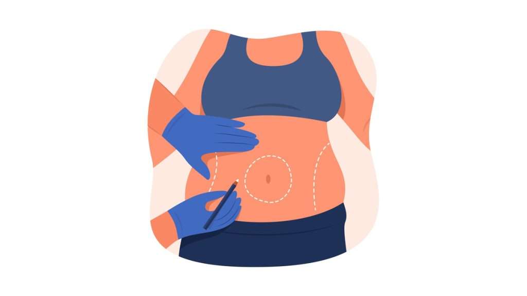 تاثیر مثبت اندیشی طب سوزنی نظر متداول طب فیزیکی برای لاغری