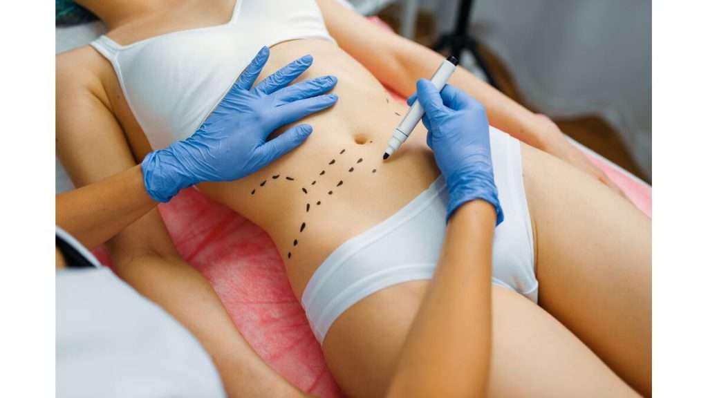 پرداخت هزینه پیکر تراشی شرایط بیمه