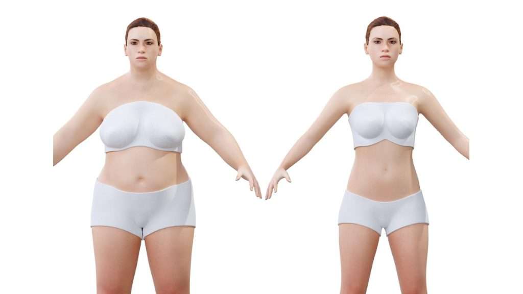 لیپوماتیک لیفت ران و باسن