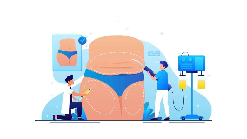 آمبولی چربی عوارض رایج لیپوساکشن