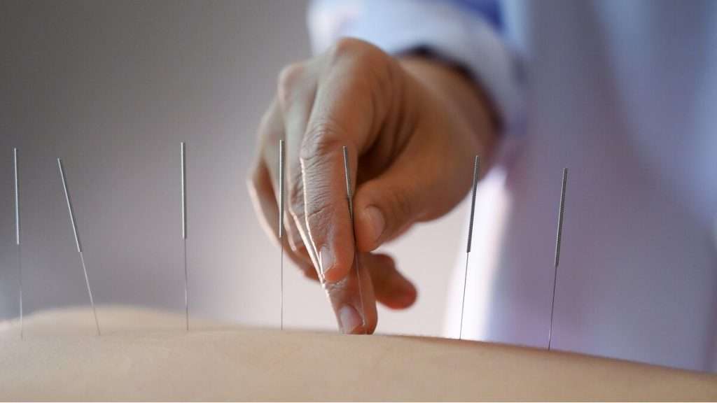 تاثیر طب سوزنی بر دیسک کمر افزایش وزن با طب سوزنی