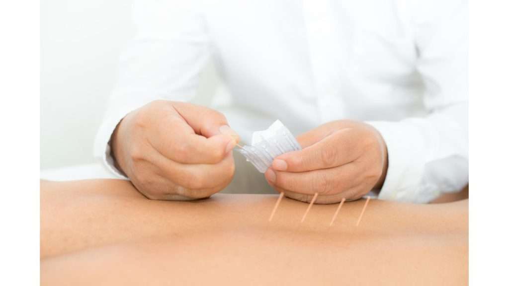 طب سوزنی زیبایی موارد منع طب سوزنی