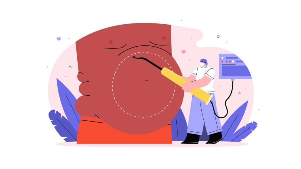 خطرات ساکشن شکم عمل زیبایی ساکشن شکم