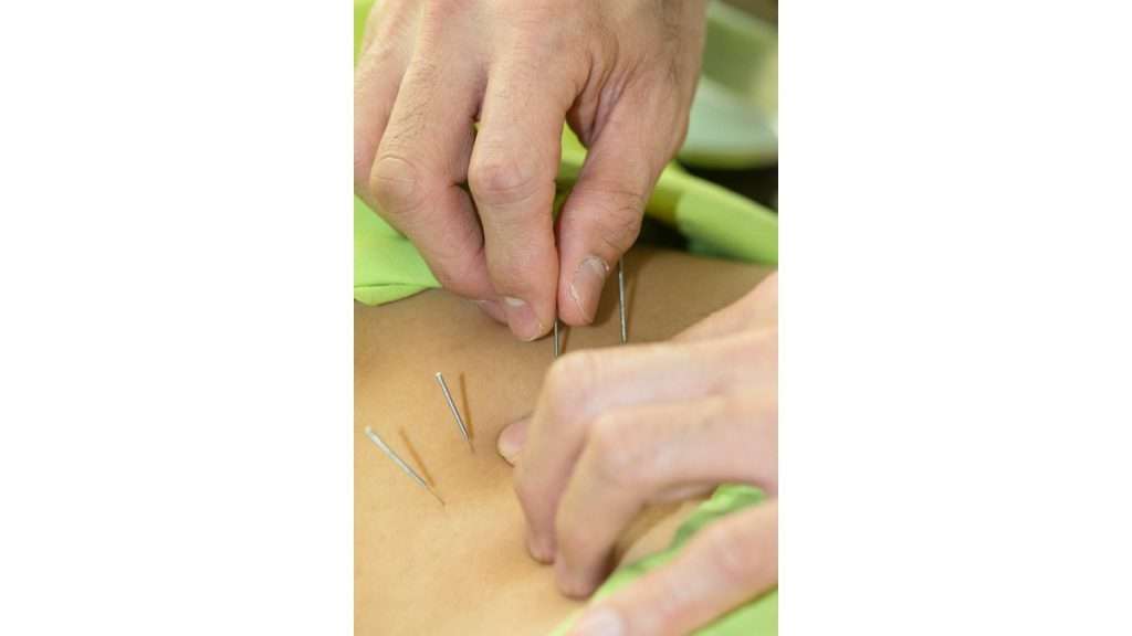 نقاط طب سوزنی طب سوزنی شکم