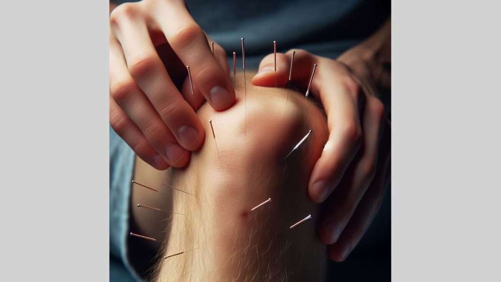 درمان پارگی رباط صلیبی طب سوزنی برای ساییدگی زانو