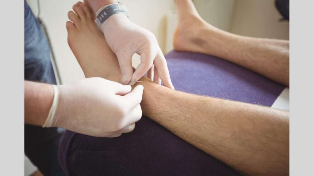 علائم مرتبط با زانو کاهش التهاب در زانو