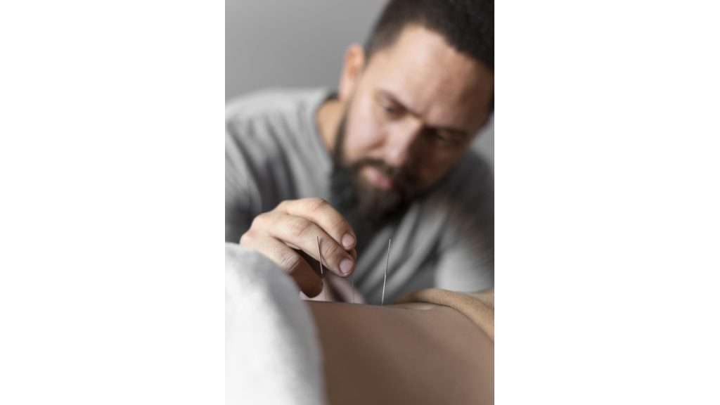 لاغری موضعی مزایای طب سوزنی برای لاغری موضعی