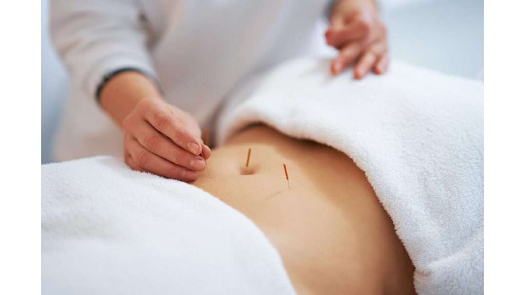 کاهش چربی شکم فواید طب سوزنی شکم