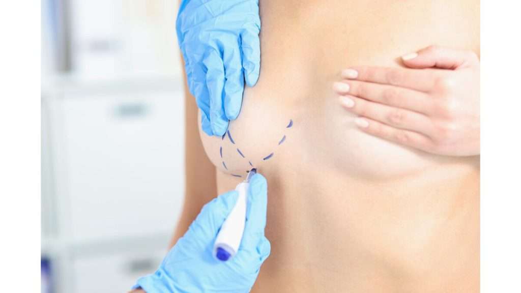 عمل کوچک کردن سینه با لیزر دوذه نقاهت عمل سینه