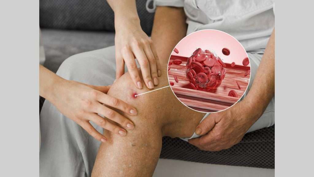 درد و خونریزی حساسیت و واکنشهای آلرژیک