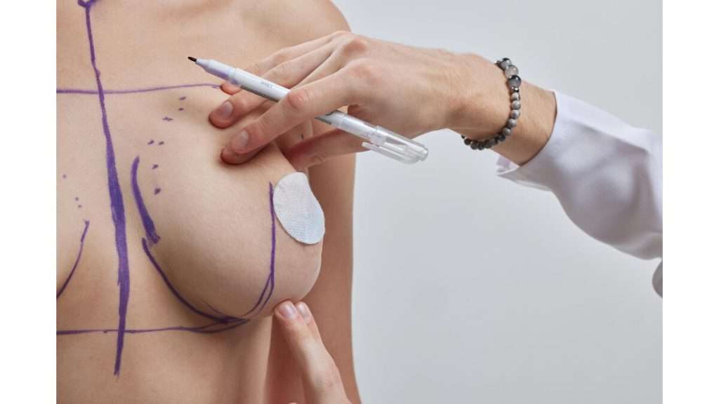 بافت اضافی سینه کوچک کردن سینه