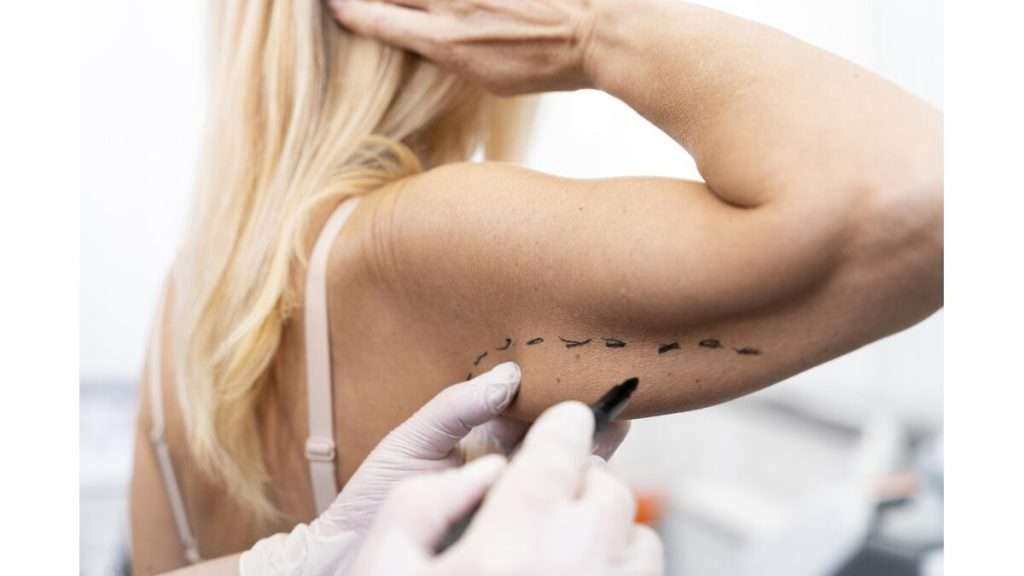 عوارض شایع لیپوساکشن لیپوساکشن