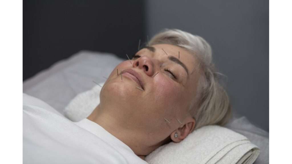 درمان میگرن با طب سوزنی هزینه هر جلسه طب سوزنی