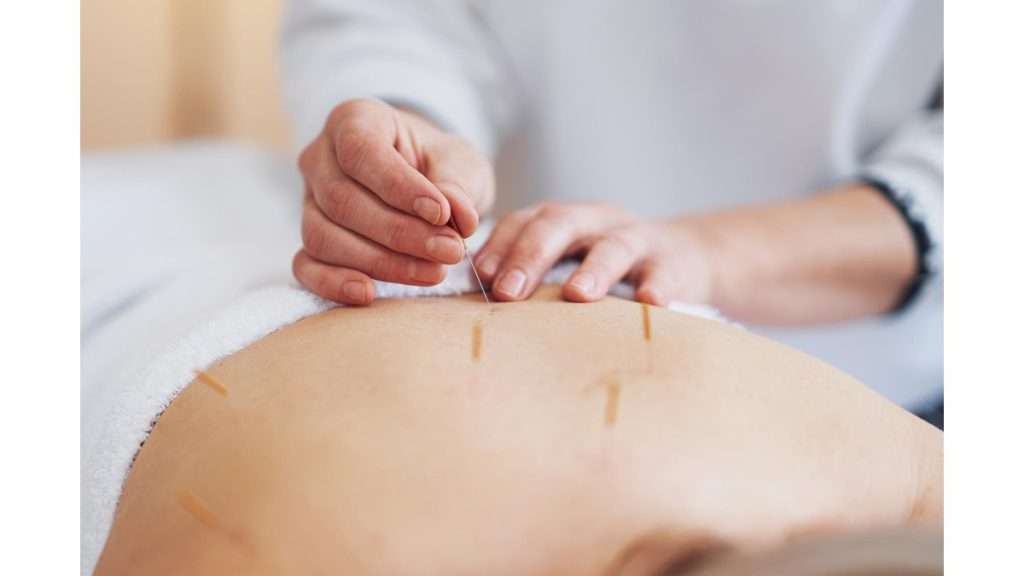 تخصص و تجربه ی متخصص طب سوزنی موقعیت مکانی مطب