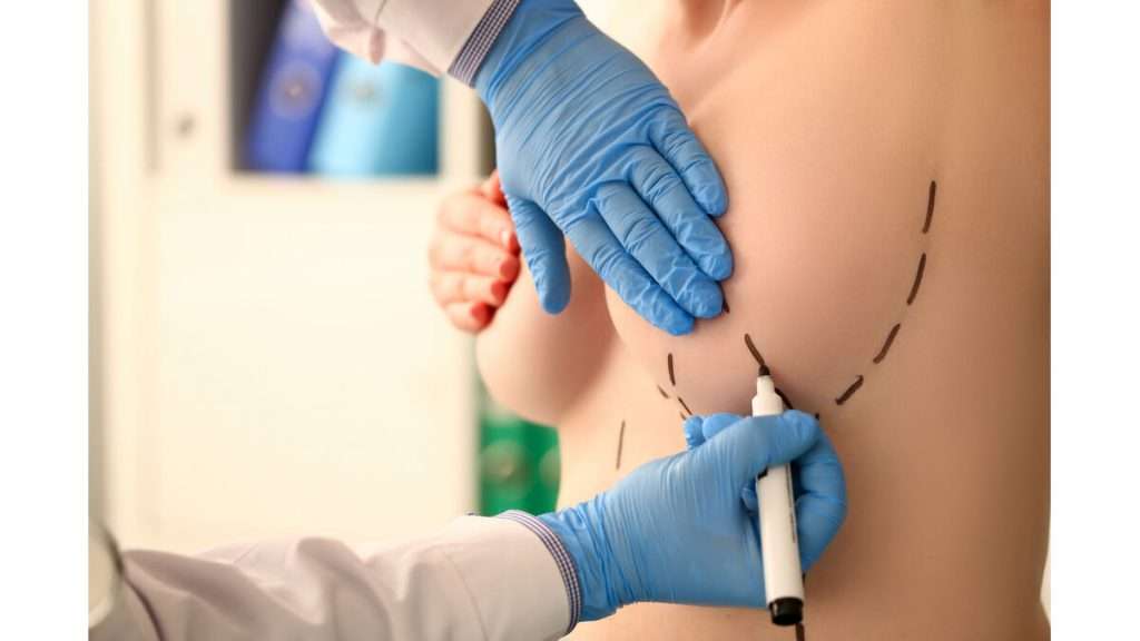 هزینه لیفت سینه لیفت سینه بدون جراحی