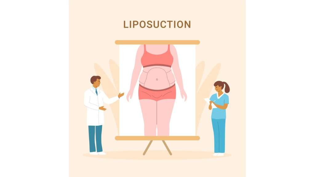 بهترین دکتر لیپوساکشن قیمت لیپوساکشن