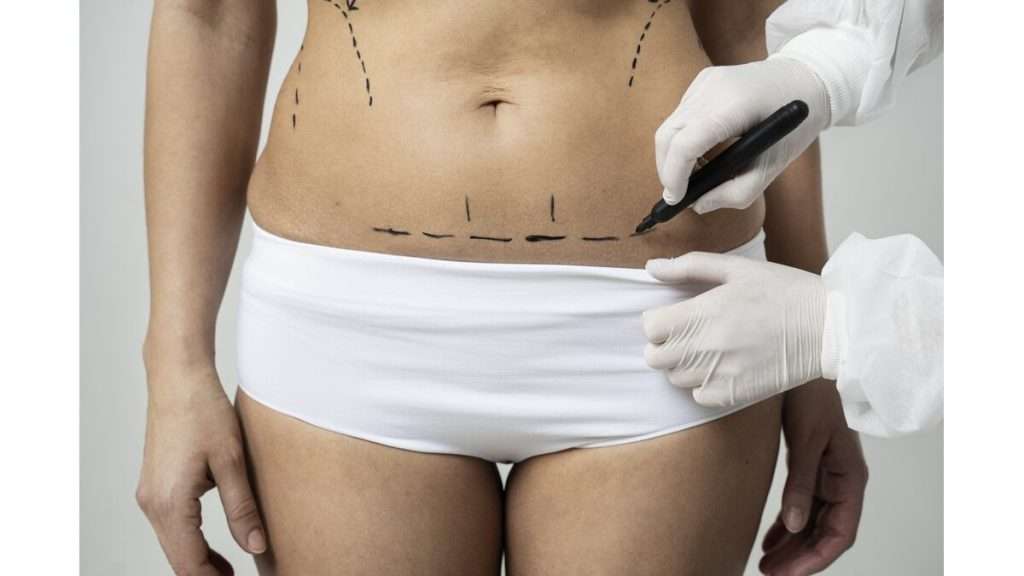 تکنیک های مختلف لیپوساکشن عمل لیپوساکشن