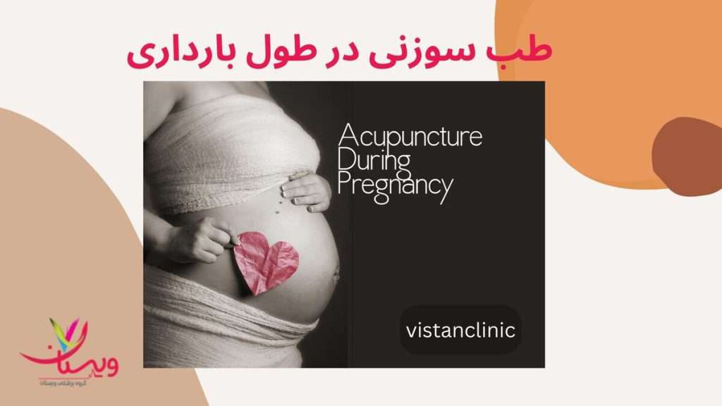 متخصص طب سوزنی