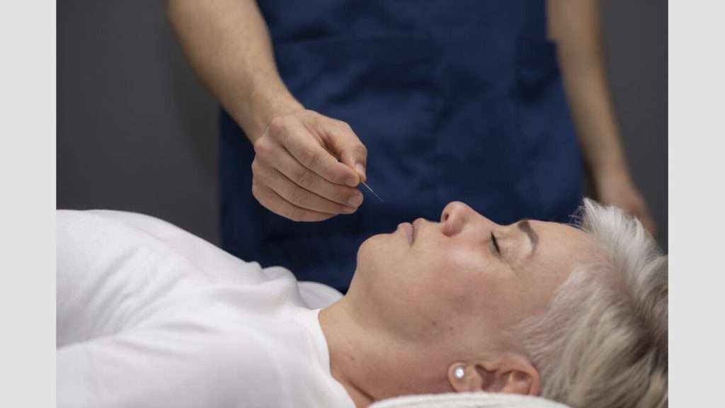 طب سوزنی برای چاقی صورت هزینه طب سوزنی صورت