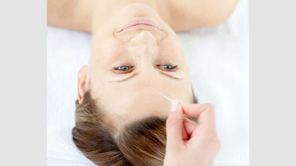 بهبود استرس کاهش درد با طب سوزنی