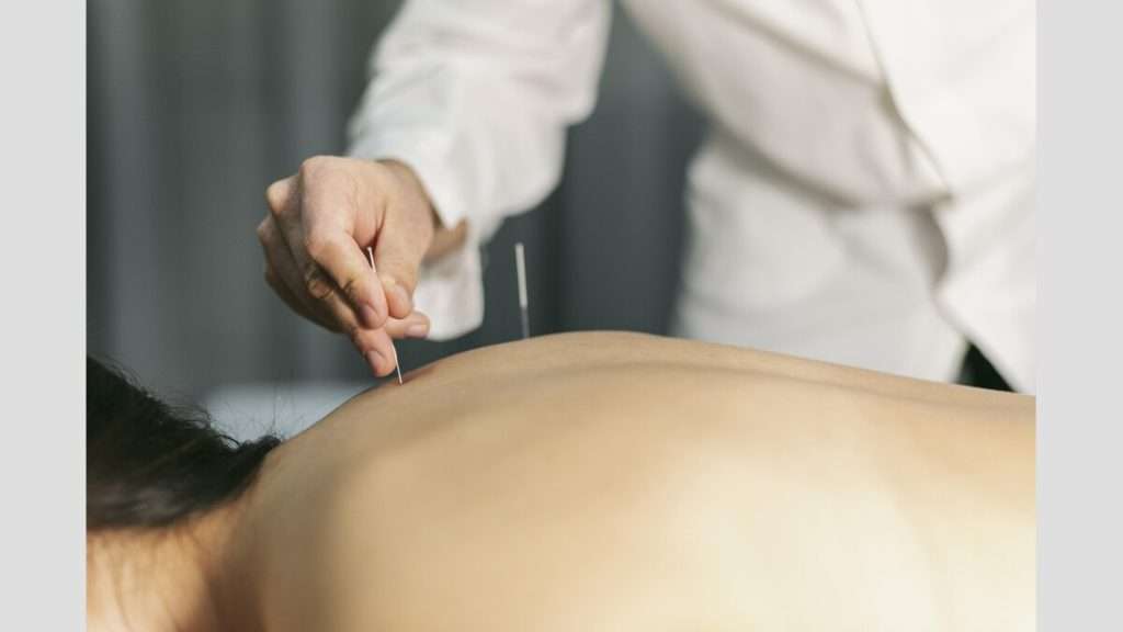 سوزنهای نازک ترک سیگار با طب سوزنی