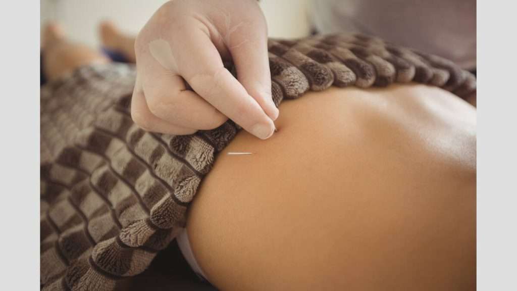 بهترین دکتر طب سوزنی تخصص و تجربه دکتر طب سوزنی