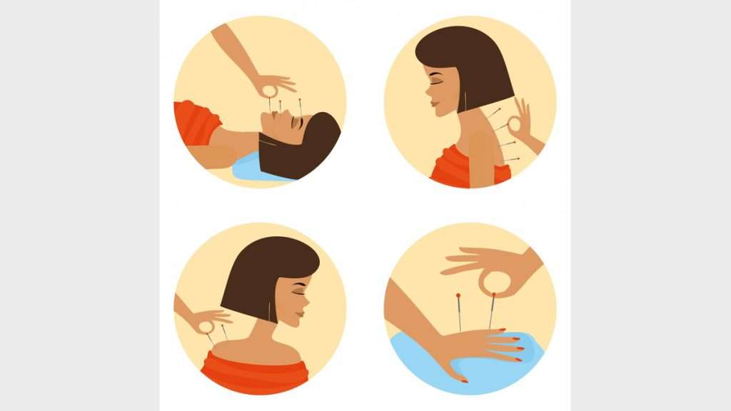 مشکلات زخم معده کیا از طب سوزنی نتیجه گرفتن