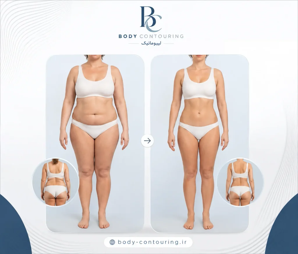 گالری عکس پیکرتراشی زنان بر اساس ناحیه بدن