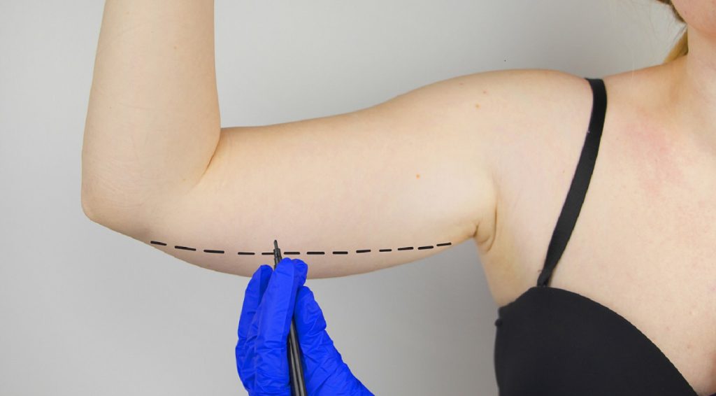 هزینه براکیو پلاستی در ایران به عوامل مختلفی از جمله مهارت وسابقه جراح،موقعیت جغرافیایی،نوع ووسعت عمل ،هزینه های بیمارستان وبیهوشی بستگی دارد