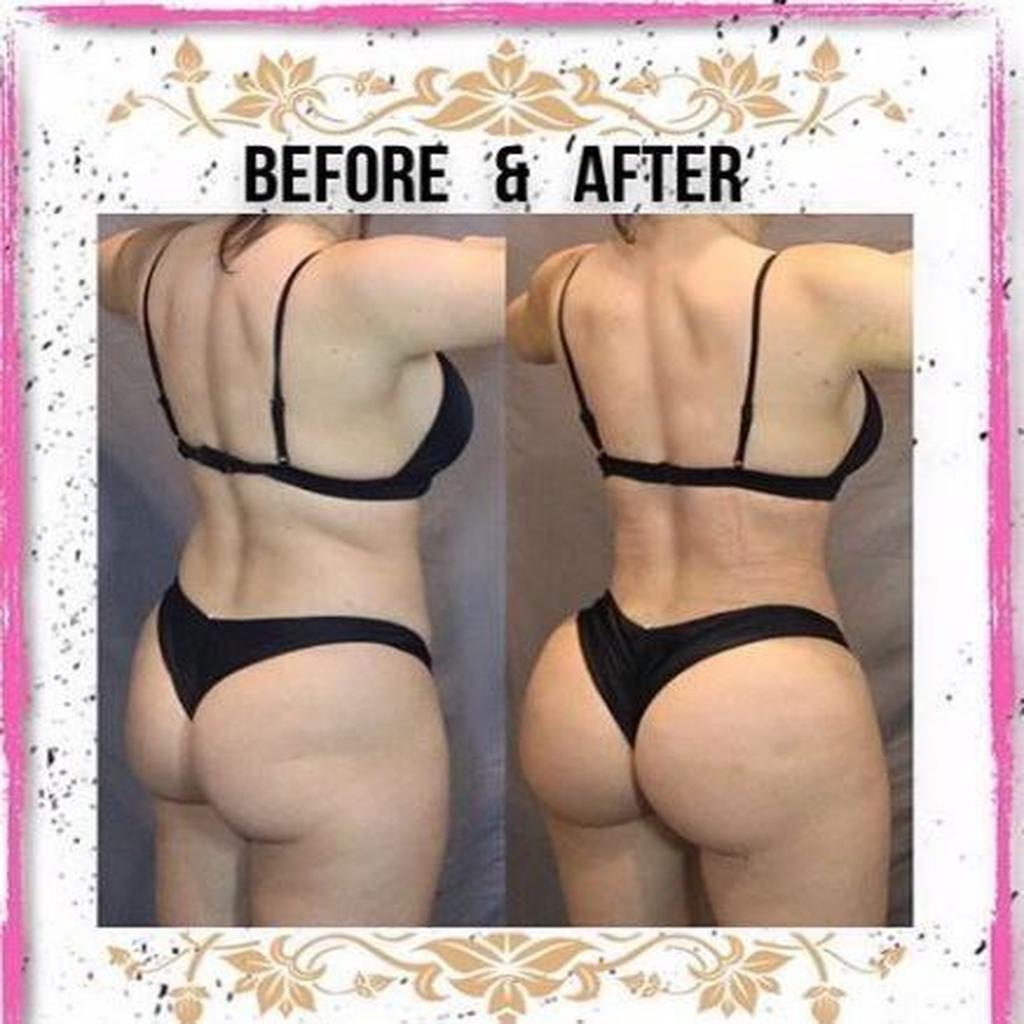 آنستزی یا مواد تسکینی قبل و بعد پیکرتراشی پشت