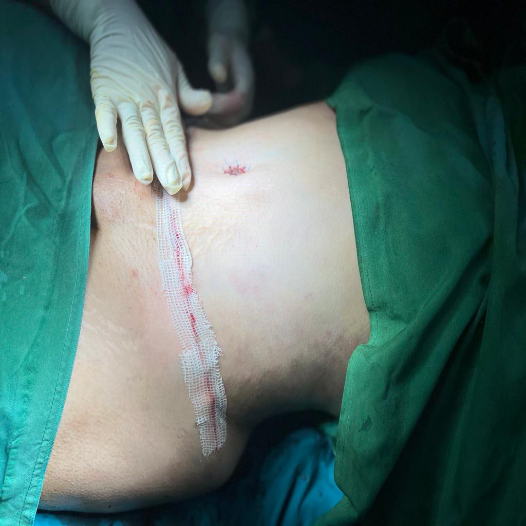 پیکرتراشی خطر مرگ در پیکرتراشی