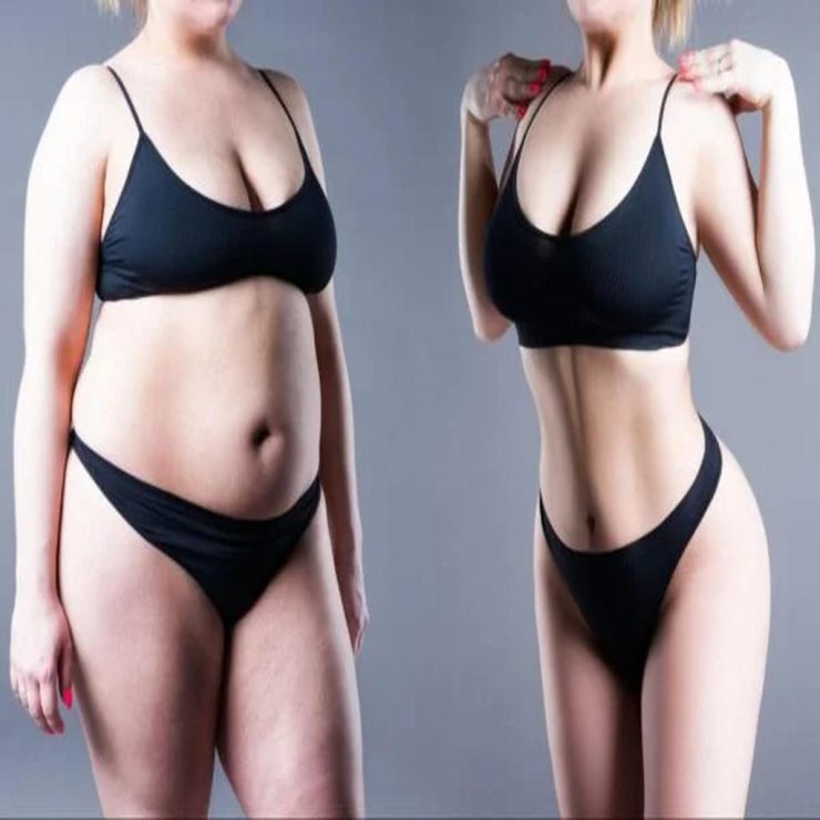 عکس پیکرتراشی زنان قبل و بعد چه چیزی را نشان می‌دهد؟