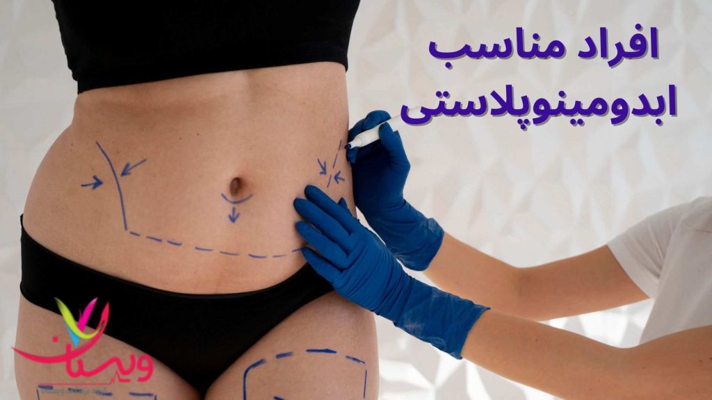 پزشک متخصص عضلات شکم