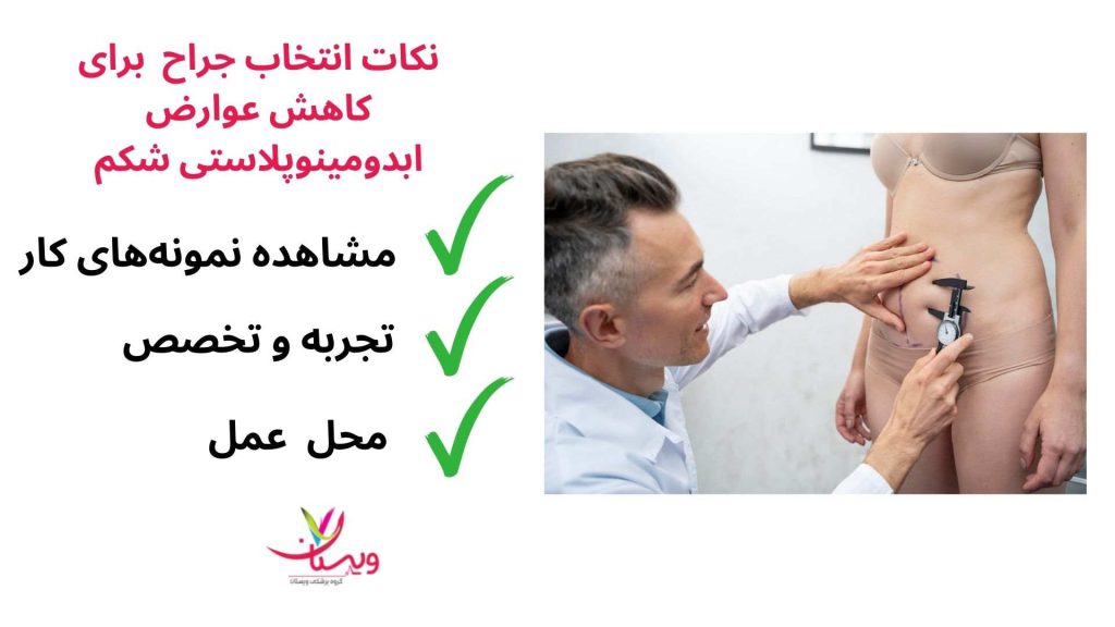  انجام ابدومینوپلاستی