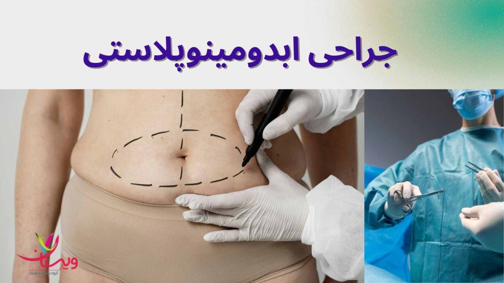 کاهش وزن بهبود شکل و ظاهر ناحیه شکم