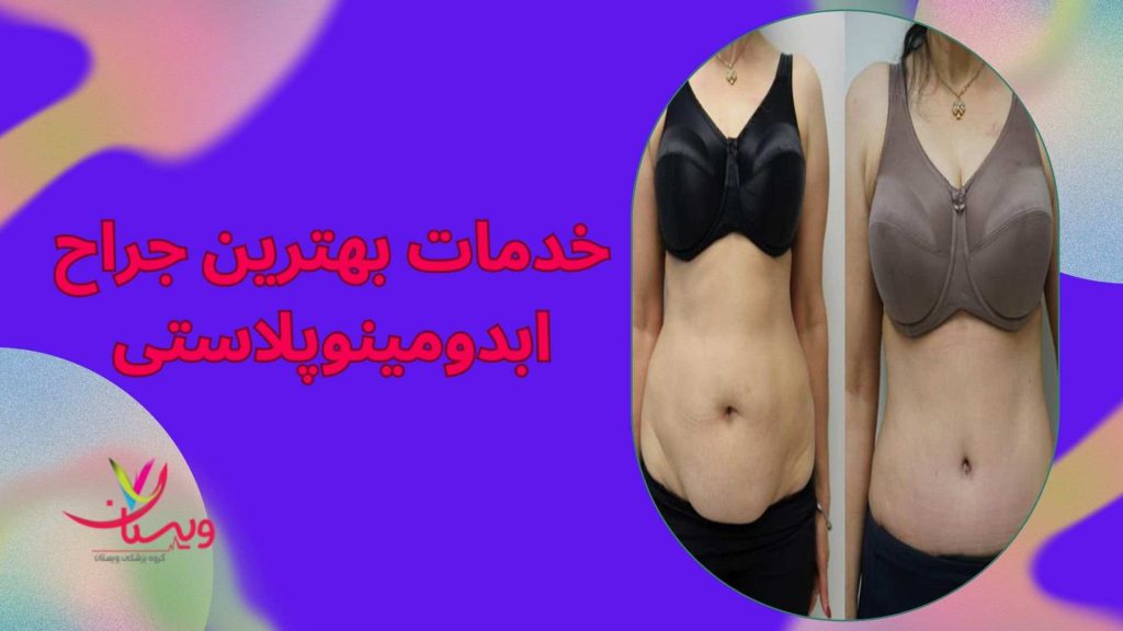 بهترین جراح ابدومینوپلاستی جراحیهای زیبایی