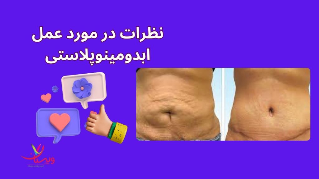 تحمل درد و زمان بهبودی کیا از عمل ابدو پشیمونن نی نی سایت