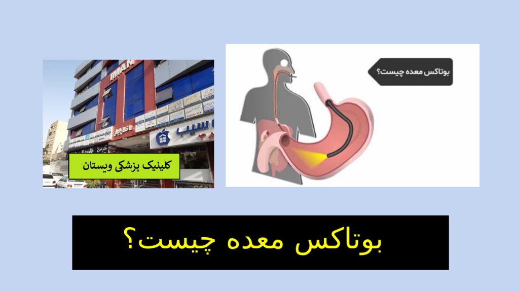 بوتاکس معده چیست؟ فردی که کاندید تزریق بوتاکس معده در کلینیک ویستان است