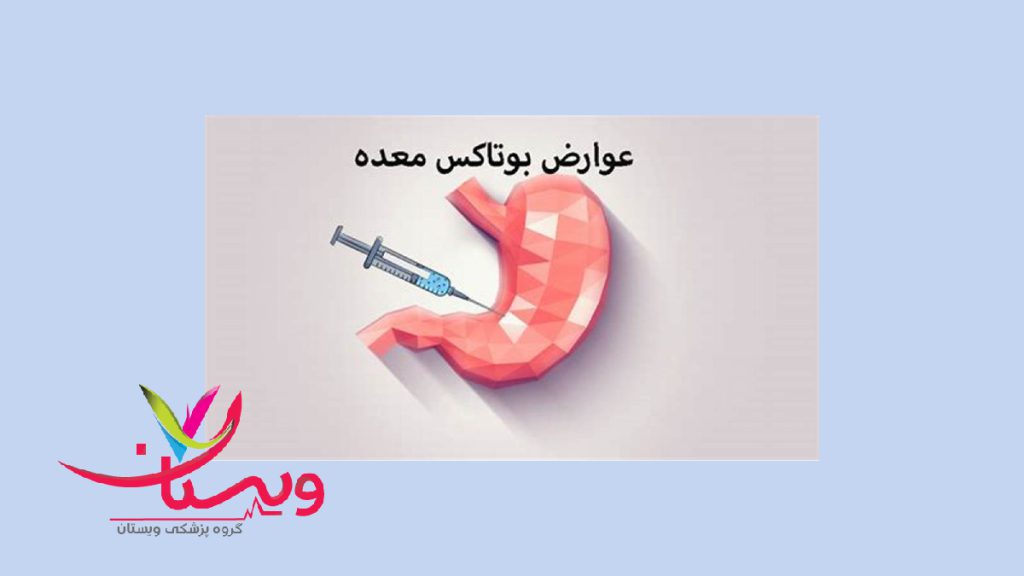 عوارض رایج تزریق بوتاکس معده معده ای که تزریق بوتاکس برای کاهش وزن داشته چه عوارضی دارد