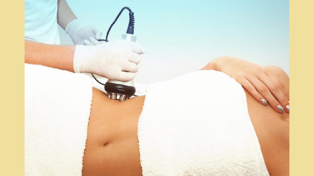 شکم وپهلوی بیمار در حال لاغری با دستگاه RF کویتیشن