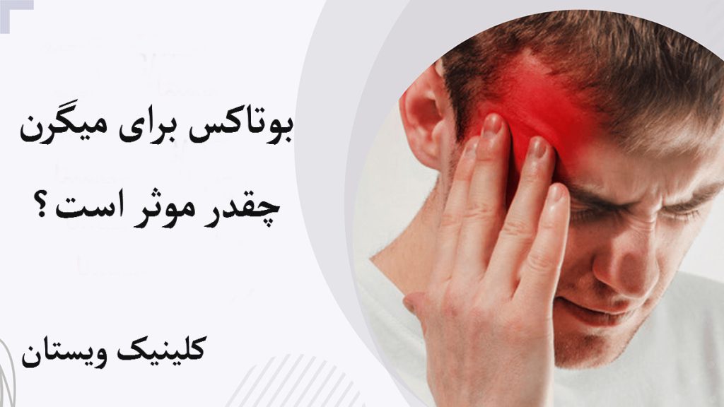 تاثیر بوتاکس میگرن یک آقا که میگرن دارد و درد در قسمت شقیقه او با رنگ قرمز نشان داده شده است