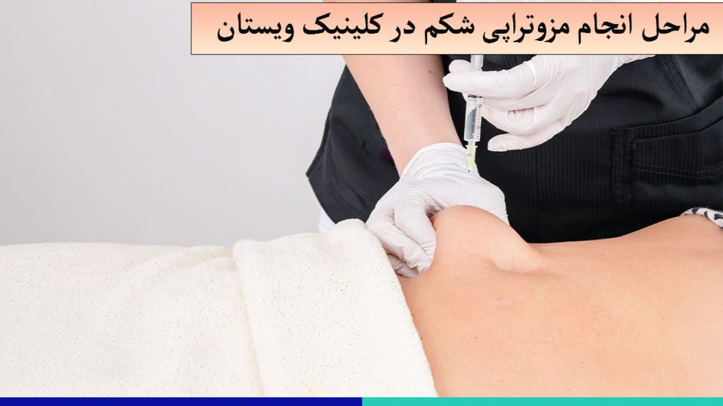 مراحل انجام مزوتراپی پزشک شکم بیمار را گرفته و درحال تزریق به آن است